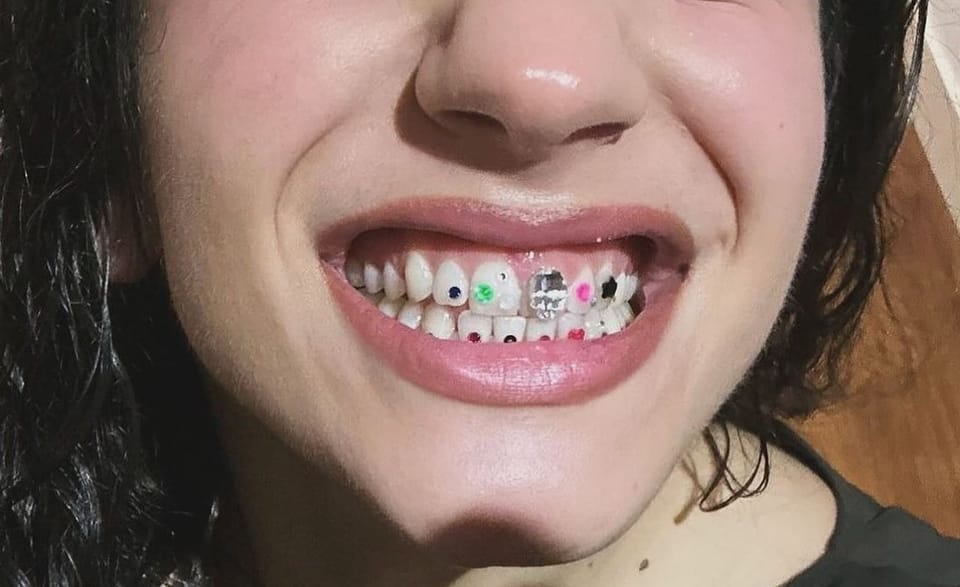 La historia de la joyería dental