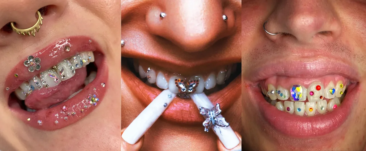 Tres marcas de joyas dentales que no te puedes perder